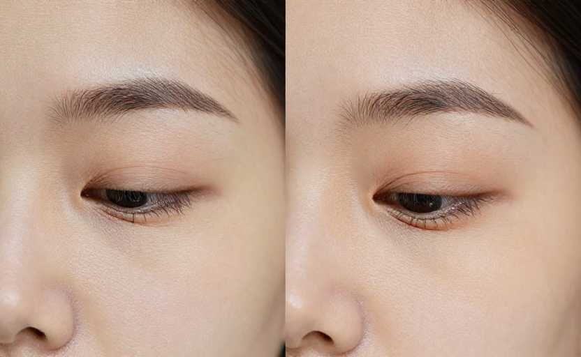 Breast cancer dietary taboos